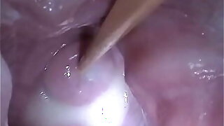 Insertion Semen Cum in Cervix Wide Stretching Pussy Reflector